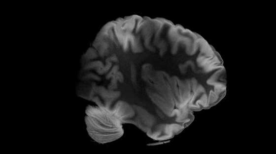 Supradyn: Supradyn Memory Test