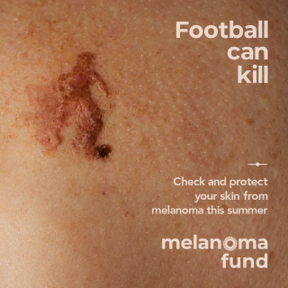 The Melanoma Fund: Silhouettes - Football