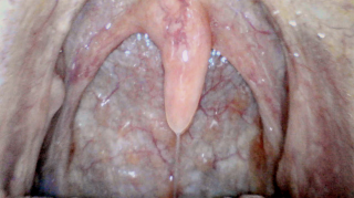 Drug Driving: Uvula