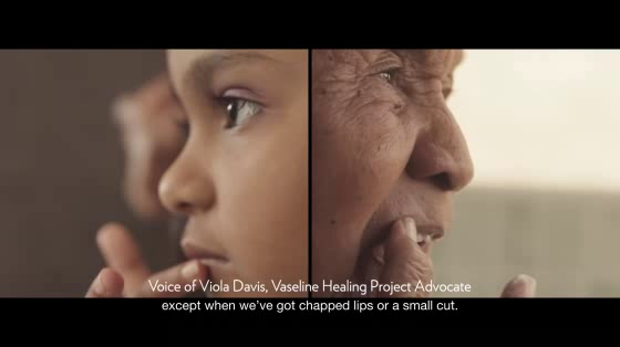 Vaseline: The Vaseline Healing Project