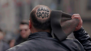 Clear Men: Bald Spots