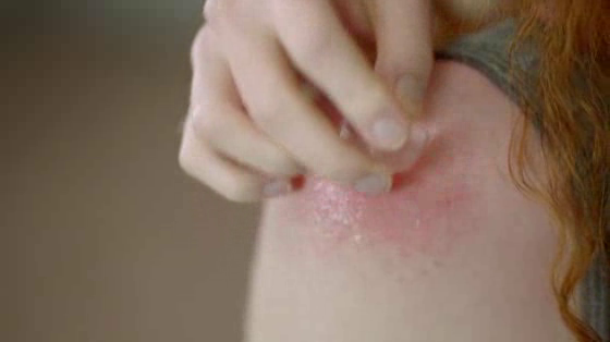 LA ROCHE-POSAY: Skin Is More Than Skin
