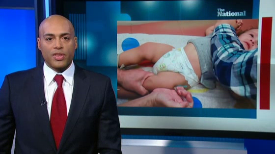 Health: Measles DM