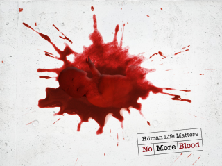 Great Cause: Human Life Matters