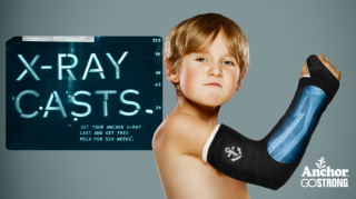 Anchor: X-Ray Casts