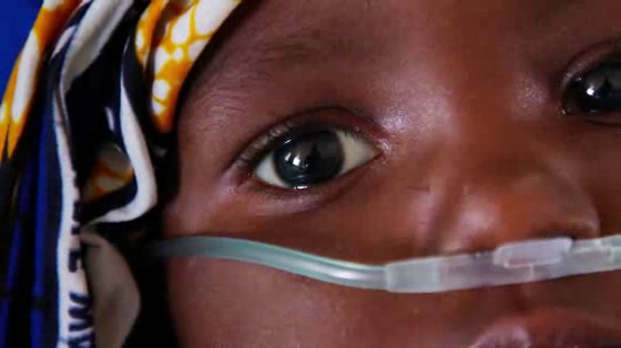 ALIMA (The Alliance for International Medical Action): Breath For All