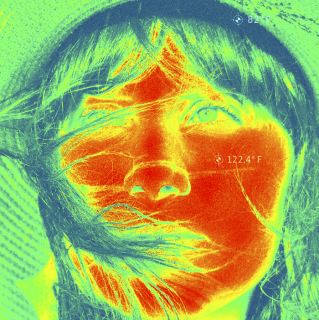 National Skin Cancer Awareness: Thermal Camera Hat