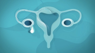 Ovarian Cancer Australia: It's time for ovary-action