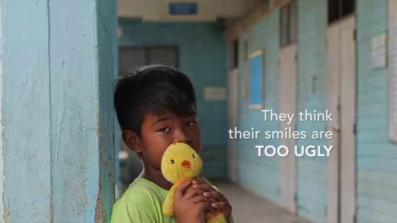 Operation Smile: The Painted Smile