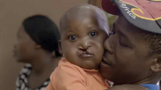 Operation Smile: Operation 45 'Episode 2'