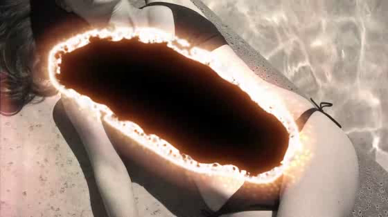 Melanoma Institute Australia: Burn